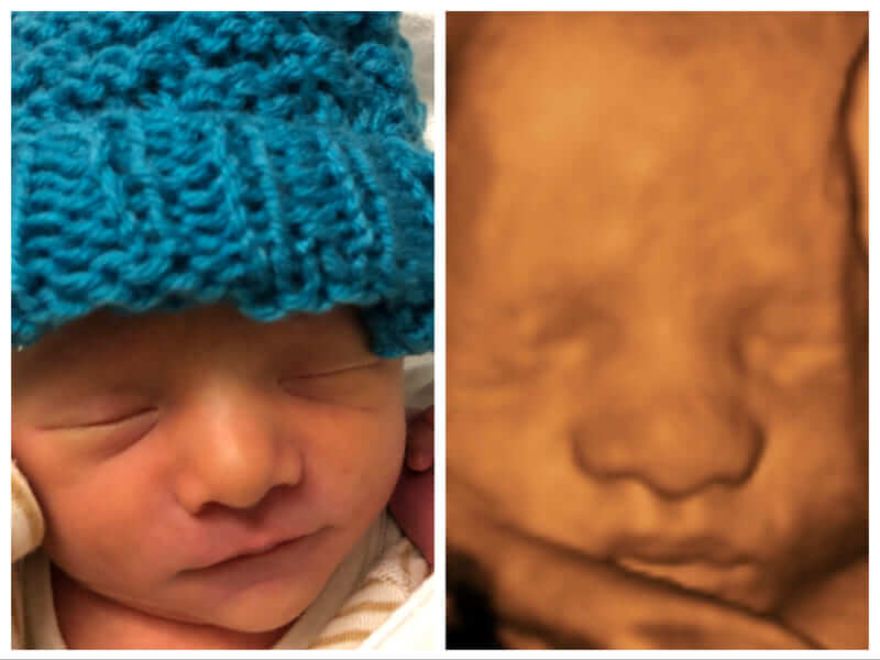 赤ちゃんの3d 4dエコー写真 実際の顔と比較してみたら似てた 旅